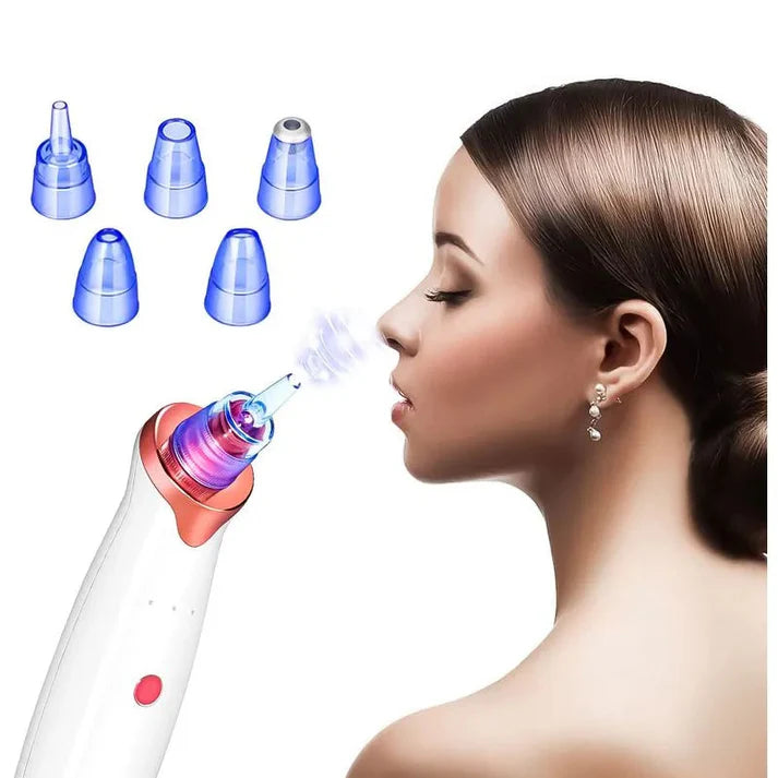 Extractor de Puntos Negros y Espinillas